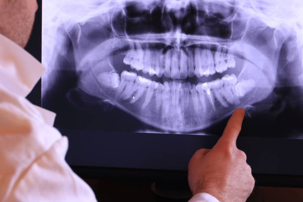 Best Emergency Tooth Extraction in Tremont, IL